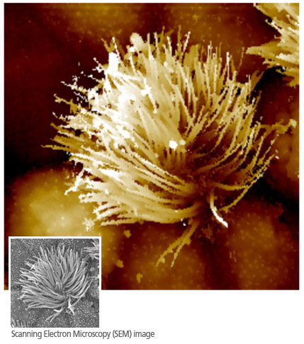 sicm-ciliated-cell-in-tracheal-tissue